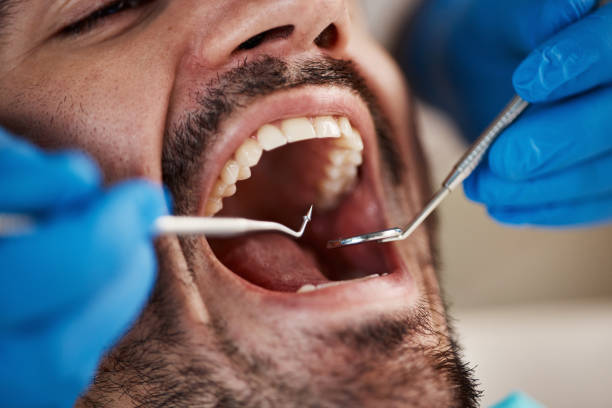 Best Emergency Denture Repair in Lockport, NY