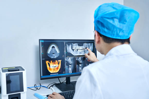 Best Emergency Dental Care for Broken or Chipped Teeth in Lockport, NY